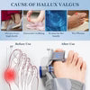 FeetifFix Bunion Corrector – Adjustable Toe Alignment Brace
